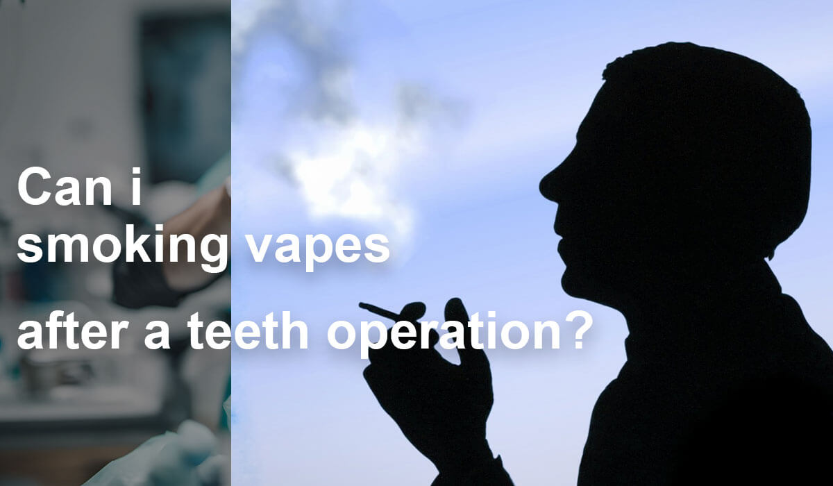 Can I Smokimg Vapes After Dental Surgery? 